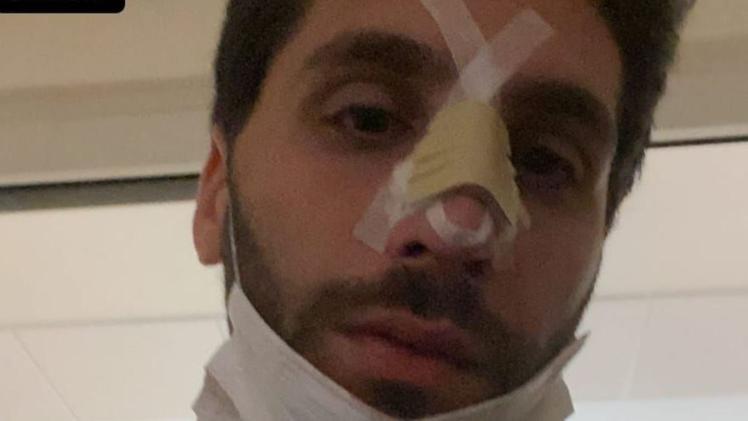 Setto nasale fratturato Filippo Lorizio racconta di essere stato aggredito in corso Porta Borsari ieri notte