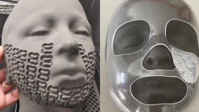 Le protesi realizzate su misura con scanner e stampanti 3D: perfetta riproduzione del volto senza pressione 